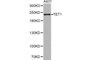 Western blot analysis of extracts of A-431 cells, using TET1 antibody. (TET1 anticorps)