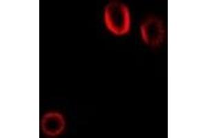 Immunofluorescent analysis of Colipase staining in Hela cells. (CLPS anticorps)