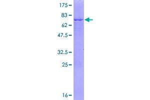 Image no. 1 for Farnesyl Diphosphate Synthase (FDPS) (AA 1-419) protein (GST tag) (ABIN1353934)