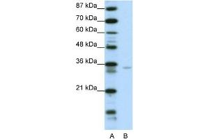 WB Suggested Anti-ZNF177 Antibody Titration:  0. (ZNF177 anticorps  (N-Term))