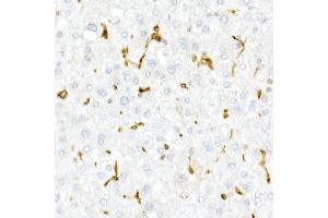 Immunohistochemistry of paraffin-embedded Human liver using CD74 antibody (ABIN6128421, ABIN6138228, ABIN6138230 and ABIN6221316) at dilution of 1:25 (40x lens). (CD74 anticorps  (AA 73-232))