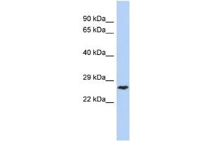 WB Suggested Anti-DIRAS1 Antibody Titration: 0. (DIRAS1 anticorps  (Middle Region))