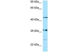 WB Suggested Anti-NPAL3 Antibody Titration: 1.