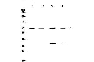 Western blot analysis of DNA Polymerase lambda using anti-DNA Polymerase lambda antibody . (POLL anticorps  (AA 307-407))