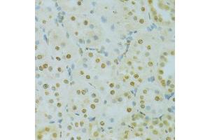 Immunohistochemistry of paraffin-embedded rat kidney using RCC1 antibody. (RCC1 anticorps  (AA 1-240))