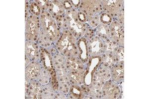 Immunohistochemical staining of human kidney with ZNF75A polyclonal antibody  shows moderate cytoplasmic and nuclear positivity in cells in tubules at 1:50-1:200 dilution. (ZNF75A anticorps)