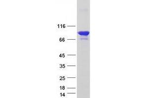 Validation with Western Blot