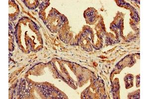 Immunohistochemistry of paraffin-embedded human prostate tissue using ABIN7145519 at dilution of 1:100 (MSMB anticorps  (AA 27-107))