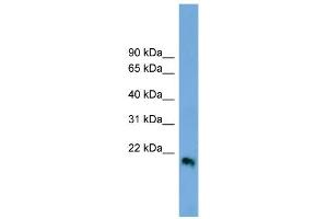 WB Suggested Anti-IFNB1 Antibody Titration:  0. (IFNB1 anticorps  (Middle Region))