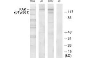 Western blot analysis of extracts from HeLa cells, Jurkat cells and COS cells, using FAK (Phospho-Tyr861) Antibody. (FAK anticorps  (pTyr861))