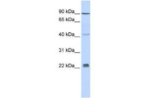 Western Blotting (WB) image for anti-Insulin Induced Gene 1 (INSIG1) antibody (ABIN2458475) (INSIG1 anticorps)