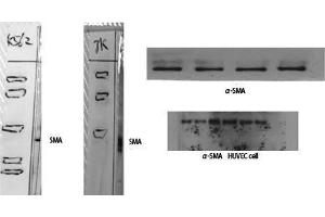 Western Blotting (WB) image for anti-alpha-SMA (N-Term) antibody (ABIN3180968) (alpha-SMA (N-Term) anticorps)