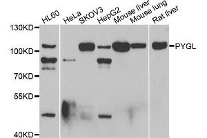 Western blot analysis of extracts of various cell lines, using PYGL antibody (ABIN5974053) at 1/1000 dilution. (PYGL anticorps)