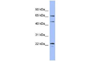 WB Suggested Anti-MAPK4 Antibody Titration: 0. (MAPK4 anticorps  (Middle Region))