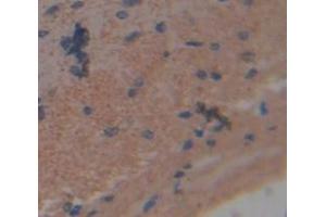 Used in DAB staining on fromalin fixed paraffin- embedded brain tissue (NCDN anticorps  (AA 2-300))