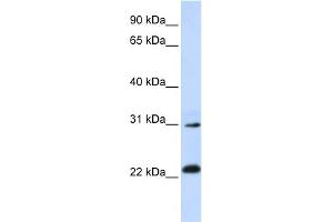 WB Suggested Anti-AP3S1 Antibody Titration: 0. (AP3S1 anticorps  (N-Term))