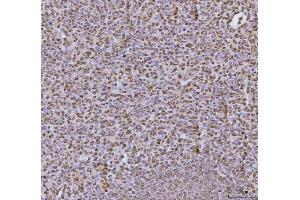 IHC analysis of hnRNP U/p120/HNRNPU using anti-hnRNP U/p120/HNRNPU antibody (ABIN7600979).