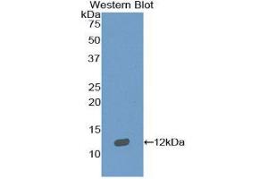 Western Blotting (WB) image for anti-Sema Domain, Immunoglobulin Domain (Ig), Short Basic Domain, Secreted, (Semaphorin) 3E (SEMA3E) (AA 651-740) antibody (ABIN1860520) (SEMA3E anticorps  (AA 651-740))