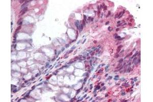 affinity purified anti-NOXO1 antibody was used at 5 ug/ml to detect signal in a variety of tissues including multi-human, multi-brain and multi-cancer slides.