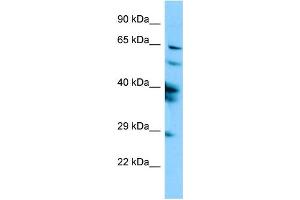 Western Blotting (WB) image for anti-Sperm Associated Antigen 16 (SPAG16) (N-Term) antibody (ABIN2790381) (SPAG16 anticorps  (N-Term))