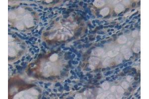 Used in DAB staining on fromalin fixed paraffin- embedded kidney tissue
