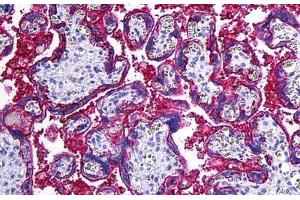 Human Placenta: Formalin-Fixed, Paraffin-Embedded (FFPE) (CD46 anticorps)