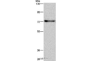 Western blot analysis of Mouse brain tissue, using PATZ1 Polyclonal Antibody at dilution of 1:250 (PATZ1 anticorps)