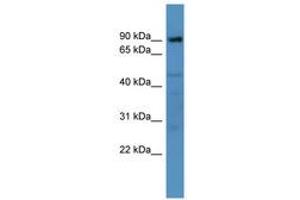 Image no. 1 for anti-ADAM Metallopeptidase Domain 22 (ADAM22) (AA 298-347) antibody (ABIN6746268)