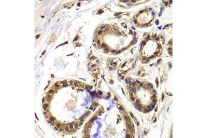 Immunohistochemistry of paraffin-embedded Human mammary gland using HDAC4 antibody at dilution of 1:100 (x40 lens). (HDAC4 anticorps)