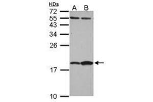 Image no. 1 for anti-Fatty Acid Binding Protein 7, Brain (FABP7) (AA 1-132) antibody (ABIN1498175) (FABP7 anticorps  (AA 1-132))