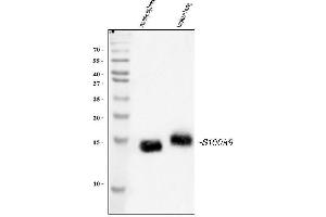 Western blot analysis of S100A9 using anti-S100A9 antibody (ABIN3042482). (S100A9 anticorps  (AA 2-113))