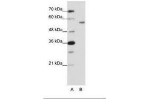 Image no. 1 for anti-Zinc Finger Protein 497 (ZNF497) (N-Term) antibody (ABIN202666) (ZNF497 anticorps  (N-Term))
