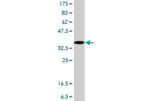 Western Blot detection against Immunogen (37.
