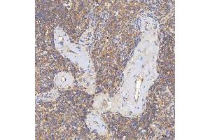 IHC analysis of SGCE using anti-SGCE antibody (ABIN7601544). (SGCE anticorps  (AA 38-407))