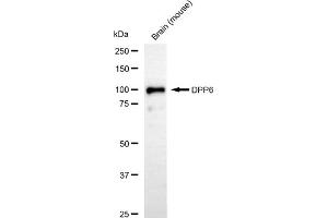 anti-Dipeptidyl-Peptidase 6 (DPP6) antibody