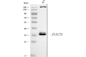 Western blot analysis of Dectin-1/CLEC7A using anti-Dectin-1/CLEC7A antibody (ABIN7599128).