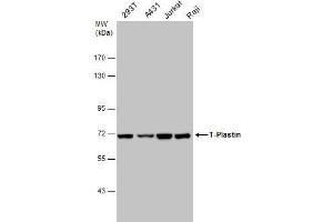 WB Image T-Plastin antibody detects T-Plastin protein by western blot analysis.