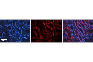 Rabbit Anti-AIFM1 Antibody   Formalin Fixed Paraffin Embedded Tissue: Human Kidney Tissue Observed Staining: Cytoplasm Primary Antibody Concentration: 1:100 Other Working Concentrations: 1:600 Secondary Antibody: Donkey anti-Rabbit-Cy3 Secondary Antibody Concentration: 1:200 Magnification: 20X Exposure Time: 0.