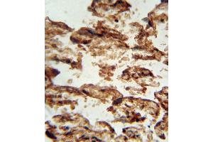 IGFBP4 antibody (Center) (ABIN652262 and ABIN2841131) immunohistochemistry analysis in formalin fixed and paraffin embedded human placenta tissue followed by peroxidase conjugation of the secondary antibody and DAB staining. (IGFBP4 anticorps  (AA 96-124))