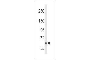 NYREN18 Antibody  (ABIN389078 and ABIN2839276) western blot analysis in SK-BR-3 cell line lysates (35 μg/lane).