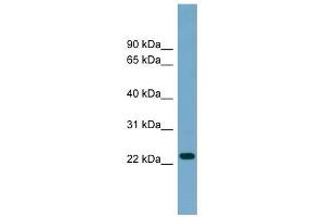 ARL8B antibody used at 1 ug/ml to detect target protein. (ARL8B anticorps  (Middle Region))