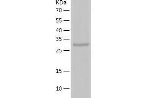 Western Blotting (WB) image for Telomerase Reverse Transcriptase (TERT) (AA 595-928) protein (His-IF2DI Tag) (ABIN7125334)