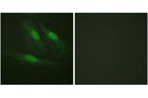 Immunofluorescence analysis of HeLa cells, using Catenin-beta (Ab-654) Antibody.