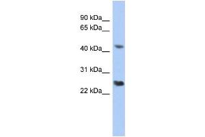WB Suggested Anti-RYBP Antibody Titration:  0. (RYBP anticorps  (Middle Region))