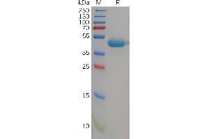 Human CD112 Protein, His Tag on SDS-PAGE under reducing condition.