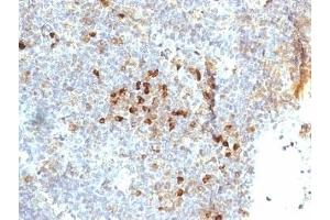Formalin-fixed, paraffin-embedded human tonsil stained with HLA-DR antibody (19-26.