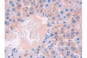 Detection of IL1R1 in Rat Liver Tissue using Polyclonal Antibody to Interleukin 1 Receptor Type I (IL1R1)