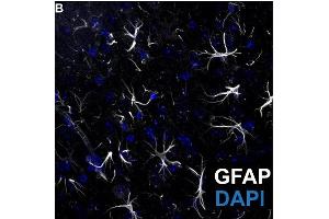 Representative image of GFP positive (white, cat. (GFAP anticorps  (AA 411-422))