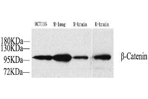 Western Blot analysis of various samples using Catenin beta Polyclonal Antibody at dilution of 1:1000. (beta Catenin anticorps)