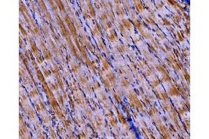IHC analysis of PKM2 using anti-PKM2 antibody (ABIN3043381). (PKM anticorps  (N-Term))